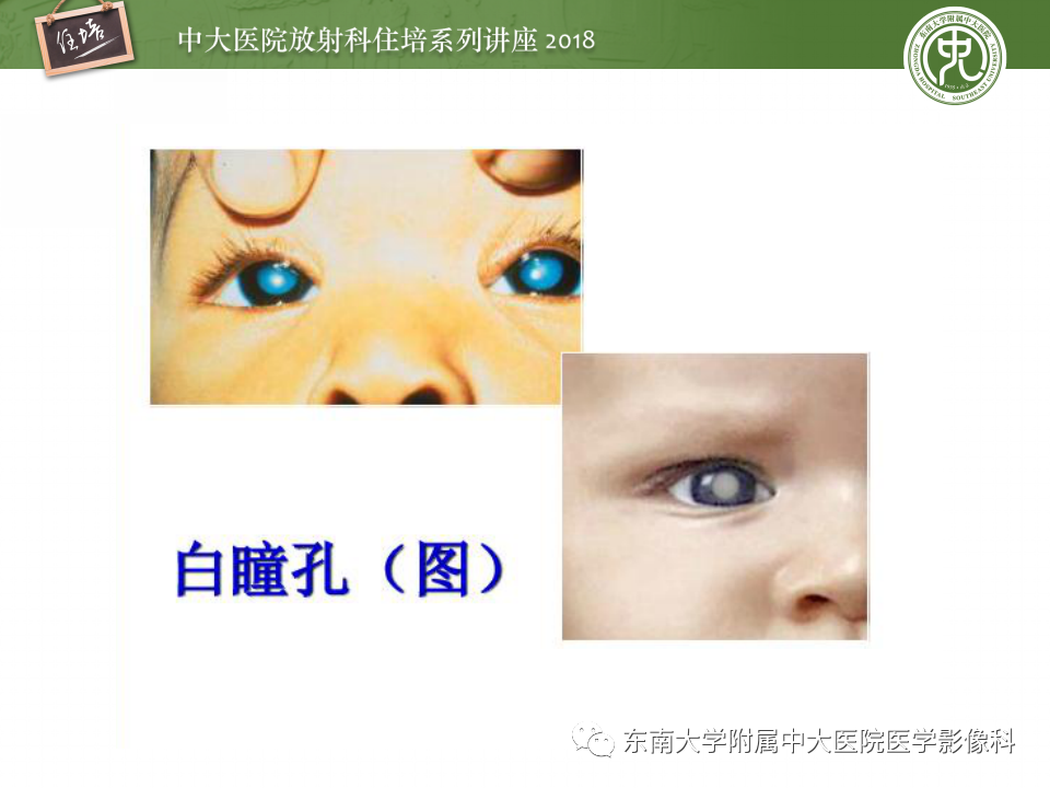 【PPT】眼眶内占位性病变的影像诊断