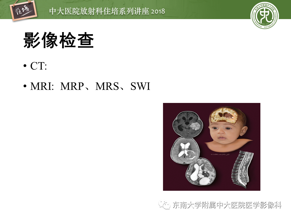 【PPT】脑室内肿瘤的影像学表现及鉴别