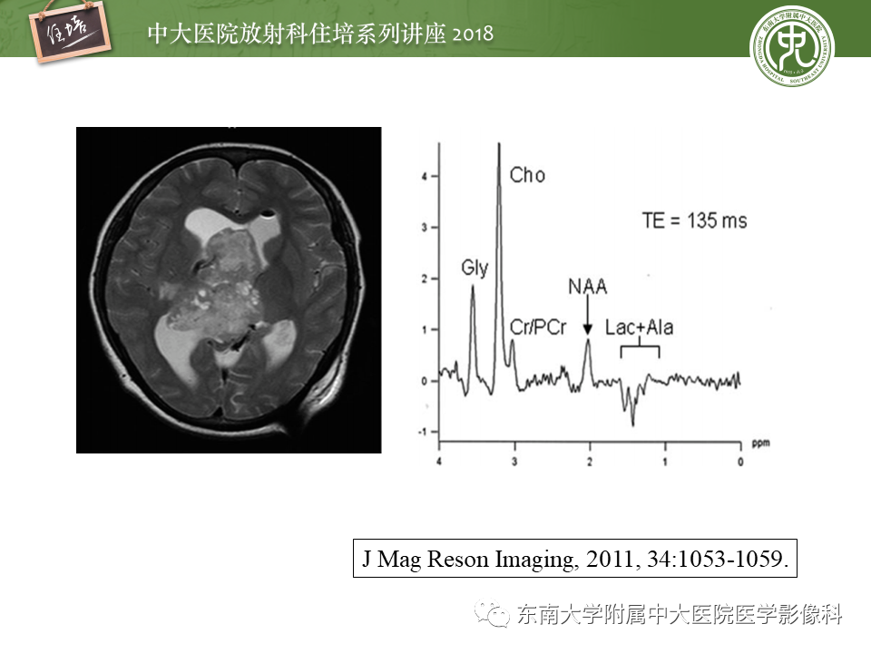 【PPT】脑室内肿瘤的影像学表现及鉴别