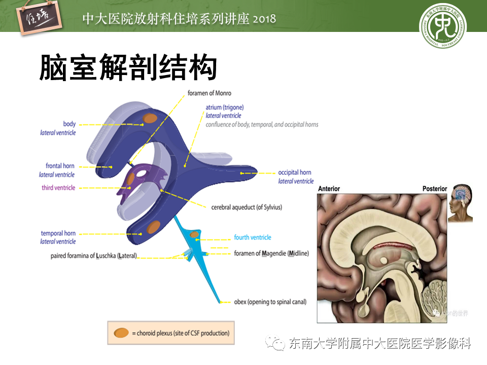 【PPT】脑室内肿瘤的影像学表现及鉴别