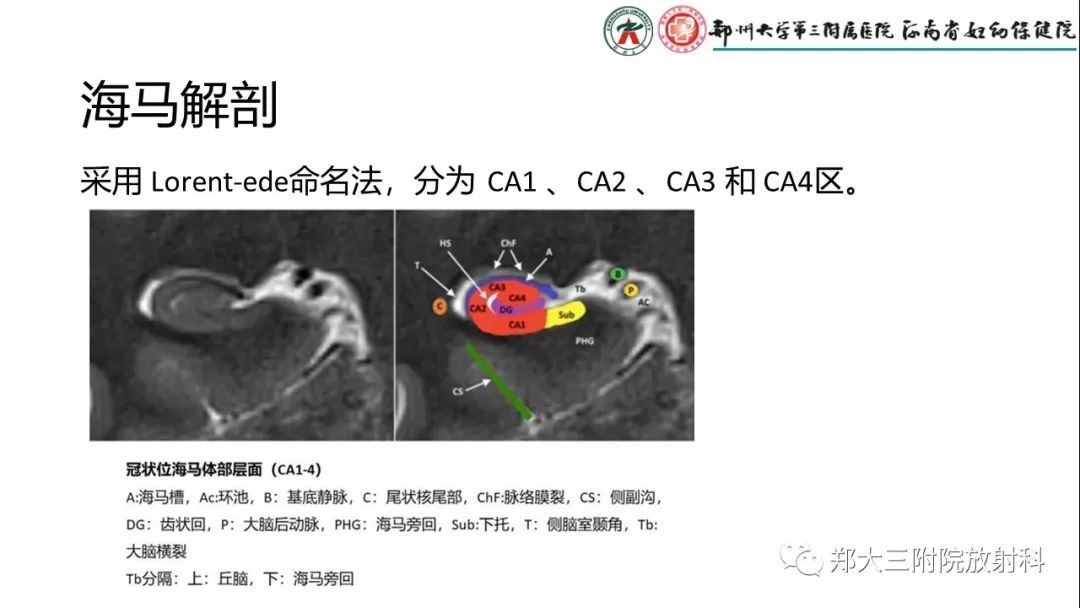 【PPT】海马硬化与癫痫