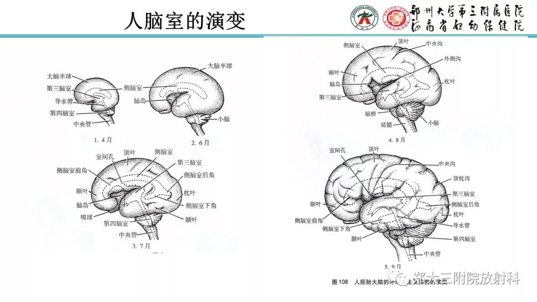 【PPT】胎儿小脑发育及常见疾病的MRI评估