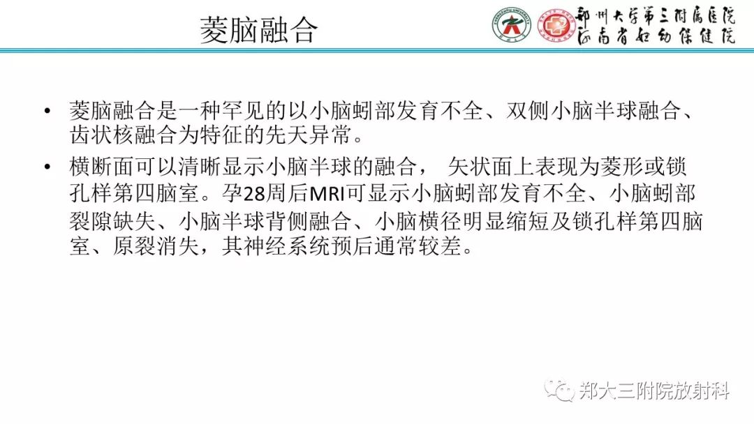 【PPT】胎儿小脑发育及常见疾病的MRI评估