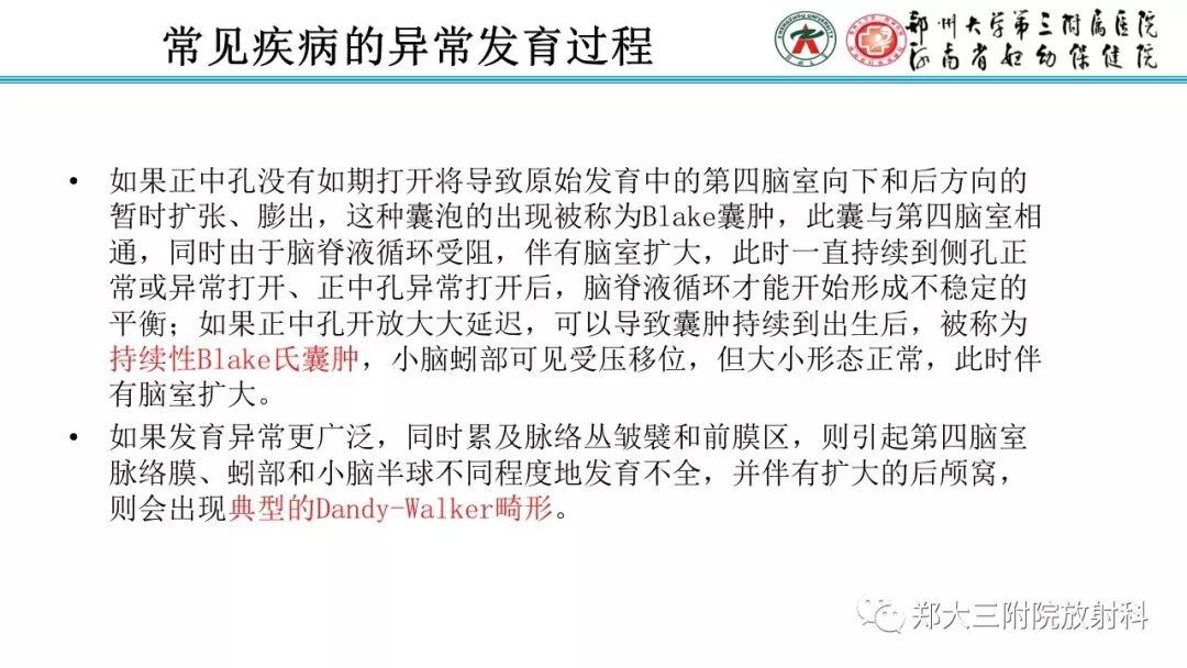 【PPT】胎儿小脑发育及常见疾病的MRI评估