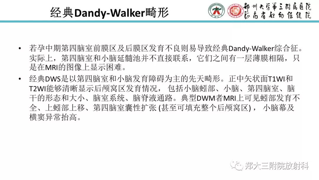 【PPT】胎儿小脑发育及常见疾病的MRI评估