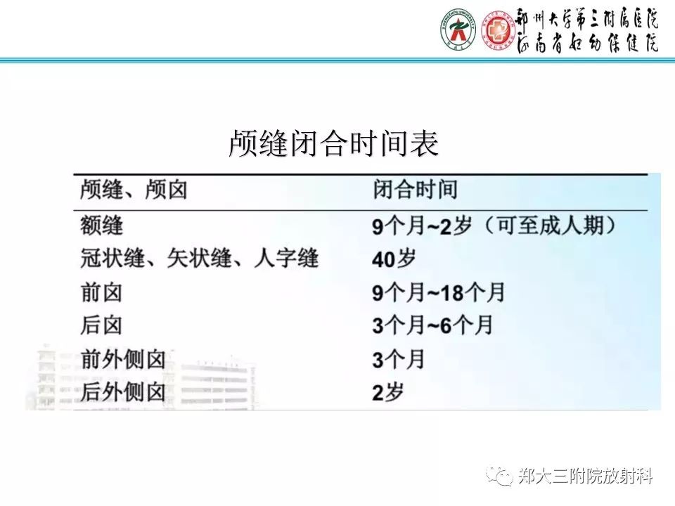 【PPT】颅缝早闭