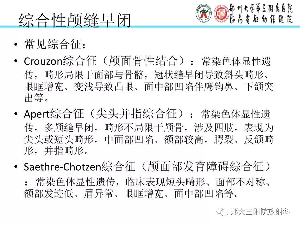 【PPT】颅缝早闭