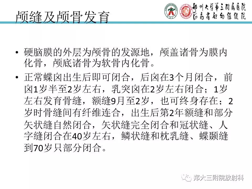 【PPT】颅缝早闭