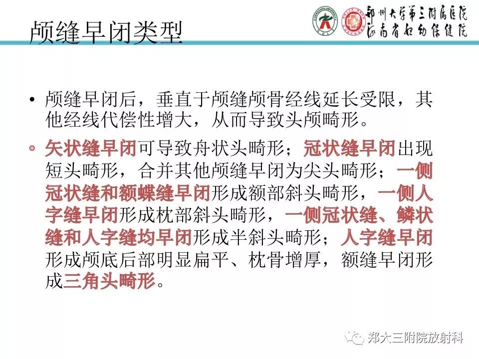 【PPT】颅缝早闭