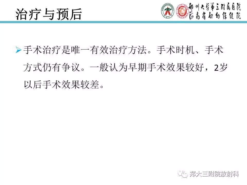 【PPT】颅缝早闭