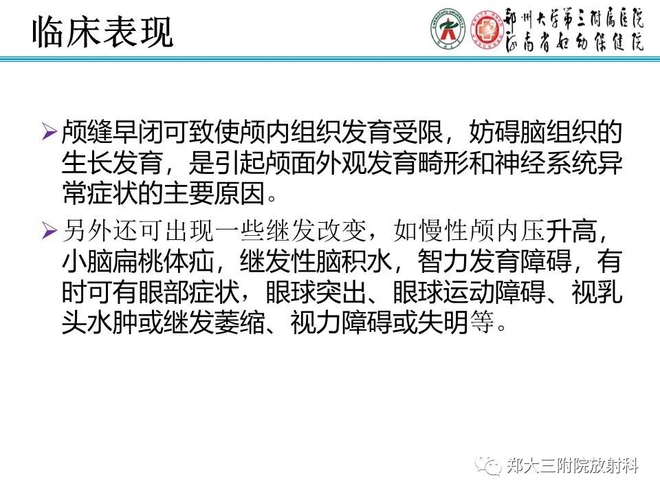 【PPT】颅缝早闭