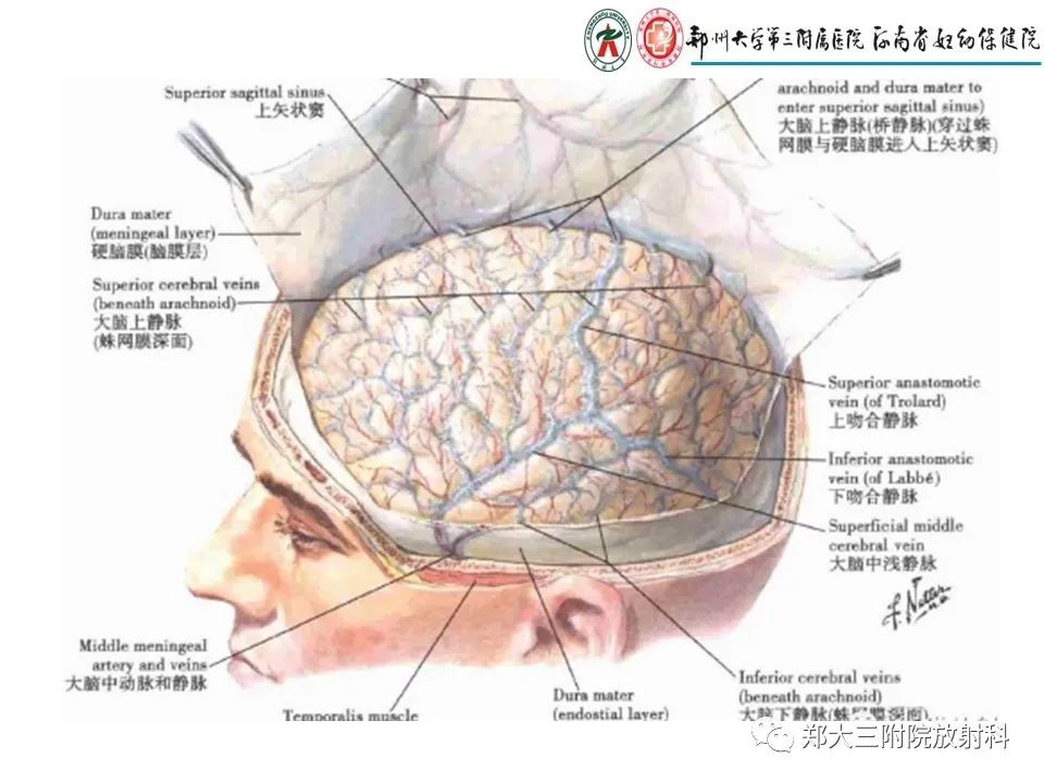 【PPT】静脉窦血栓的影像诊断及误区