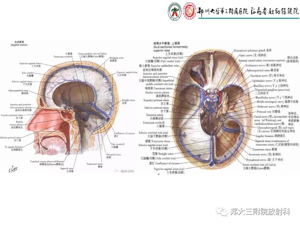 【PPT】静脉窦血栓的影像诊断及误区