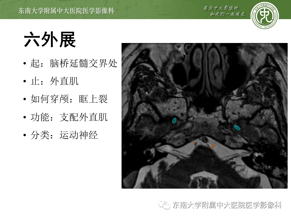 【PPT】颅神经原发肿瘤