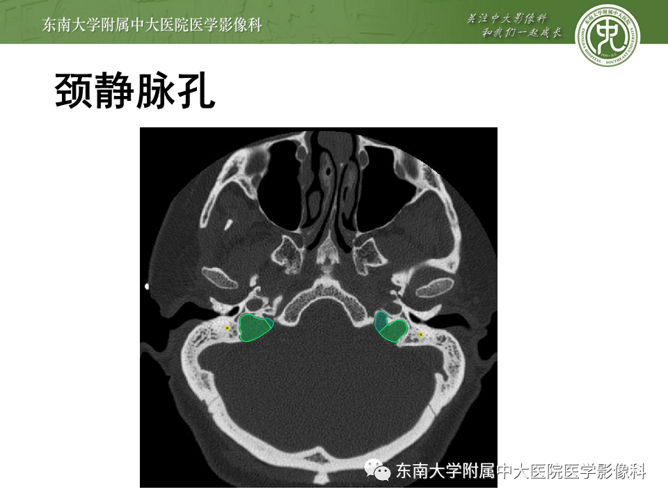 【PPT】颅神经原发肿瘤