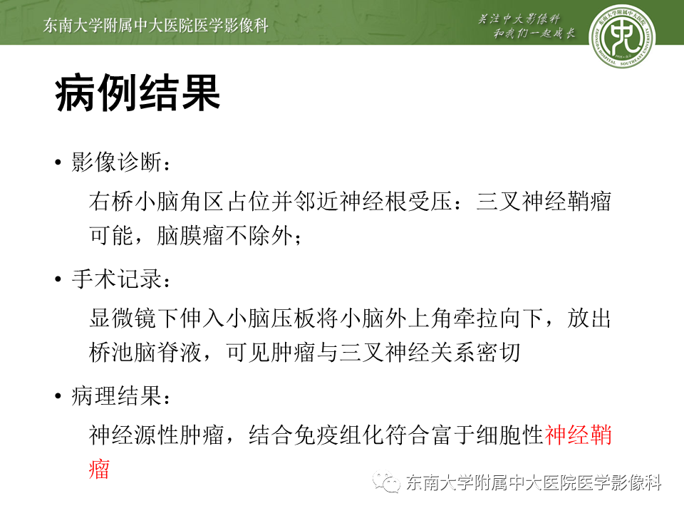 【PPT】颅神经原发肿瘤