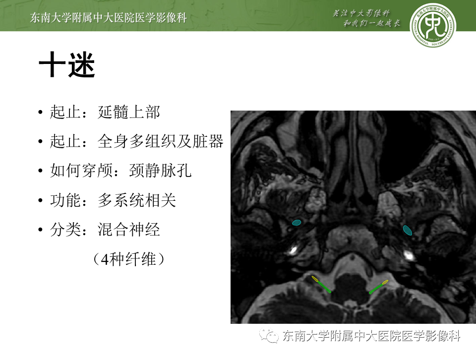 【PPT】颅神经原发肿瘤