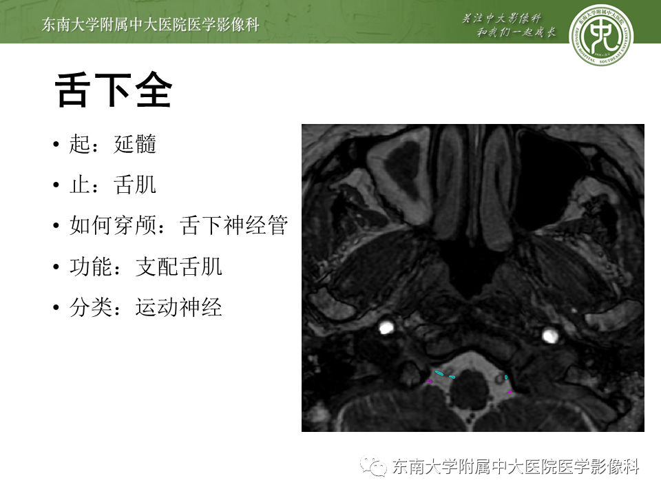 【PPT】颅神经原发肿瘤