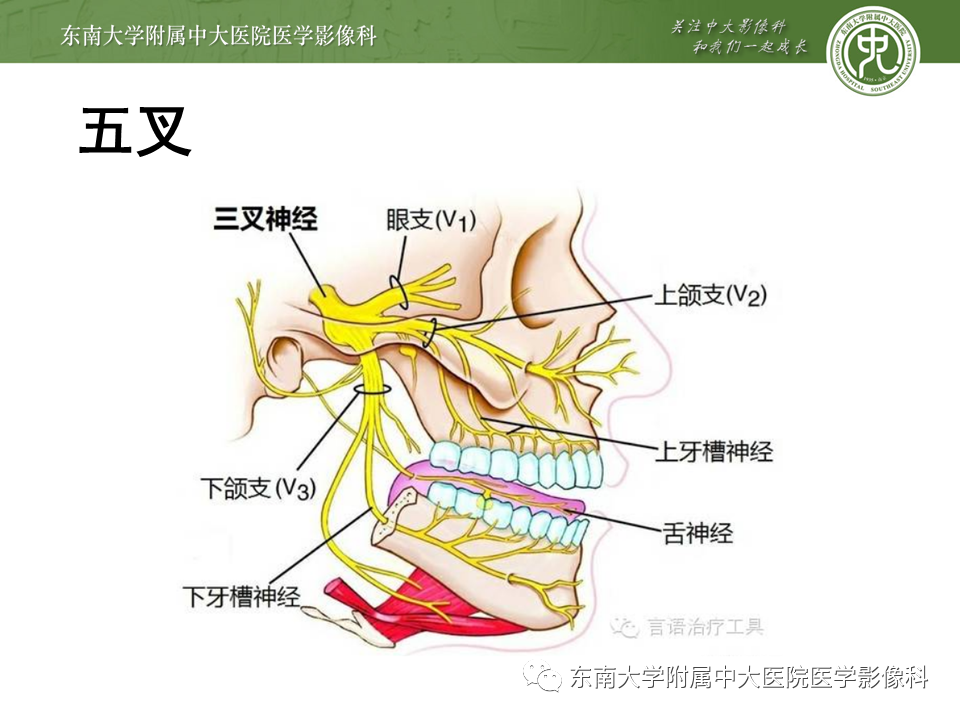 【PPT】颅神经原发肿瘤