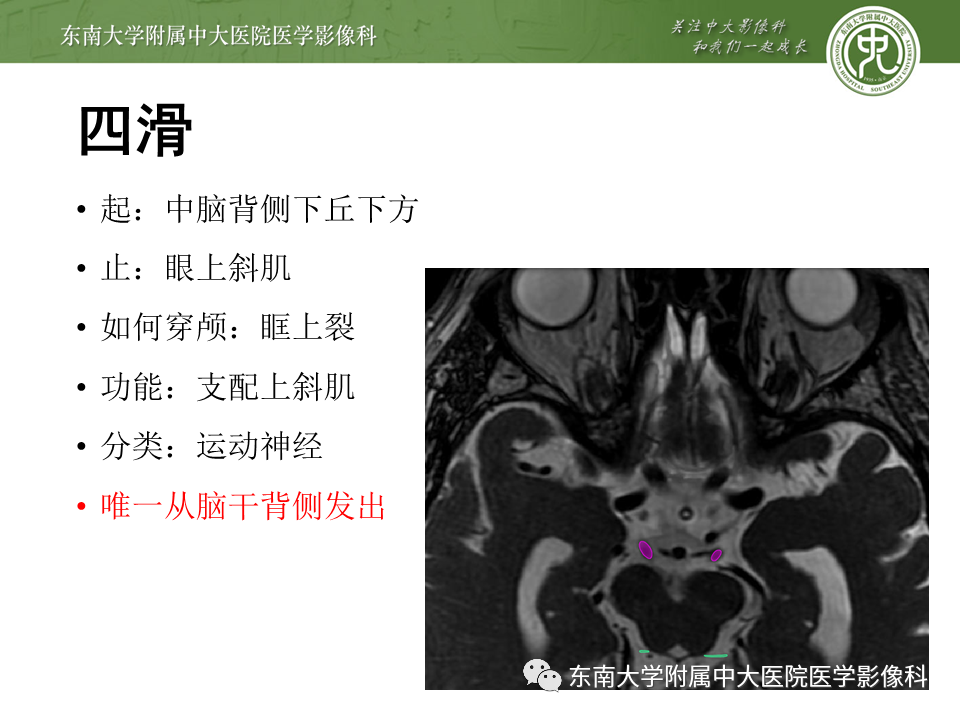 【PPT】颅神经原发肿瘤
