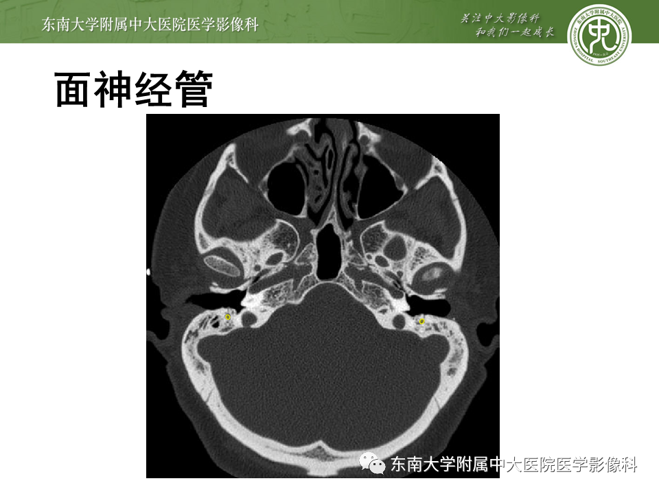 【PPT】颅神经原发肿瘤