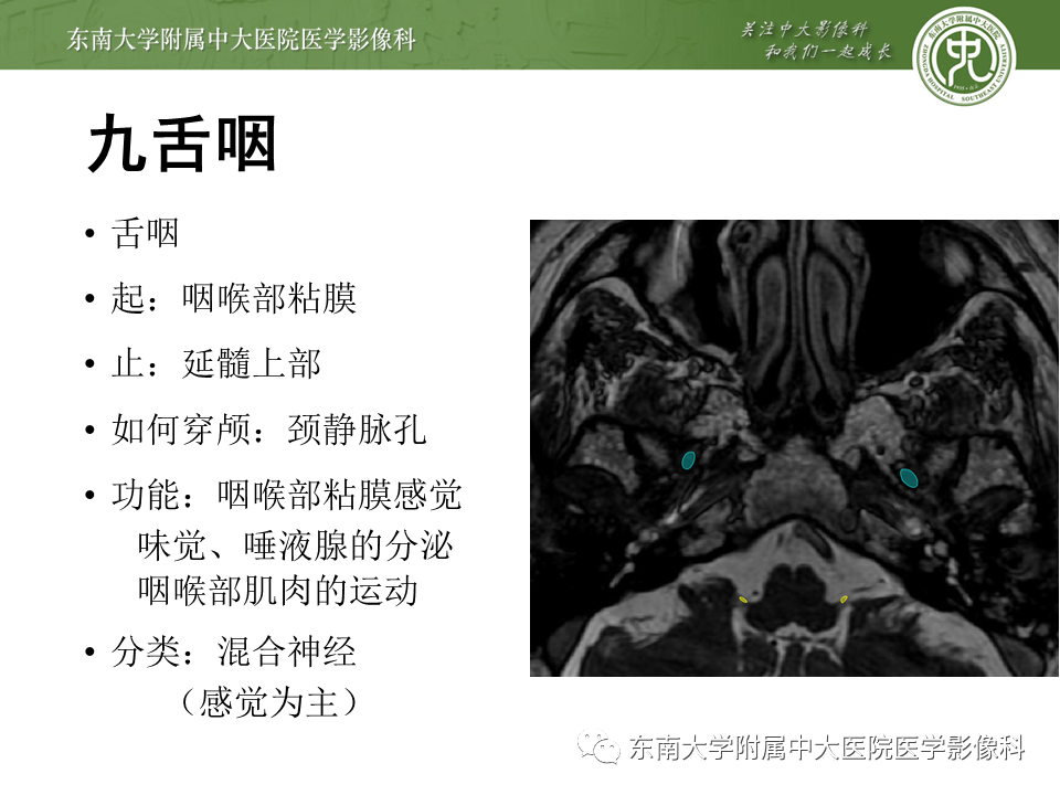 【PPT】颅神经原发肿瘤