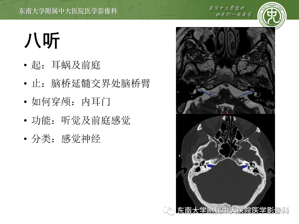 【PPT】颅神经原发肿瘤