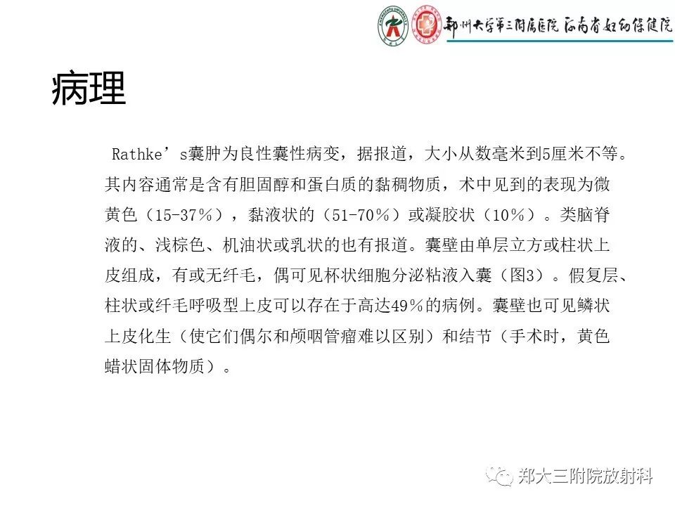 【PPT】Rathke 's 囊肿