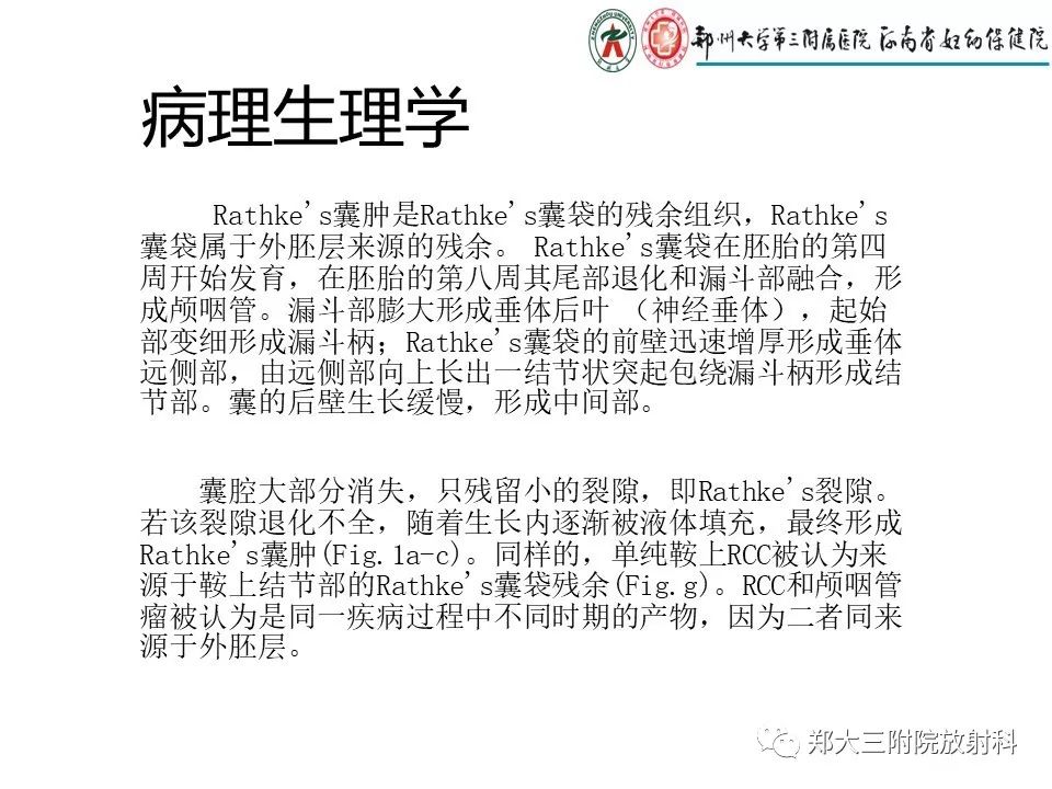 【PPT】Rathke 's 囊肿