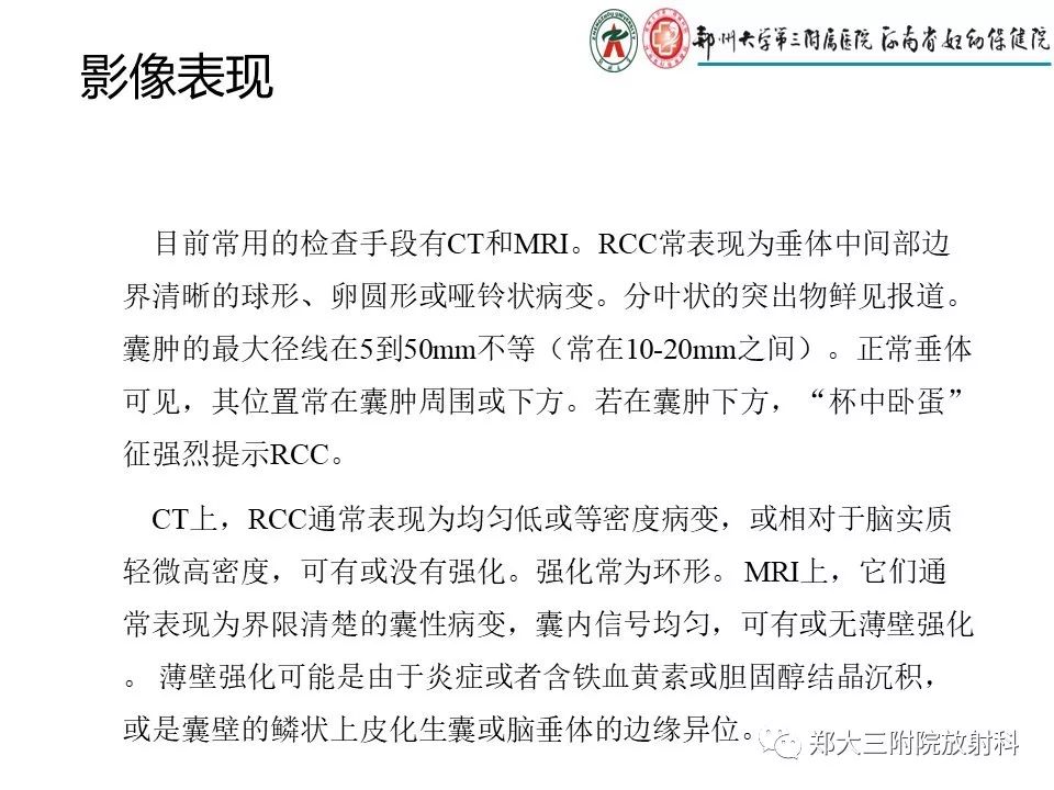 【PPT】Rathke 's 囊肿