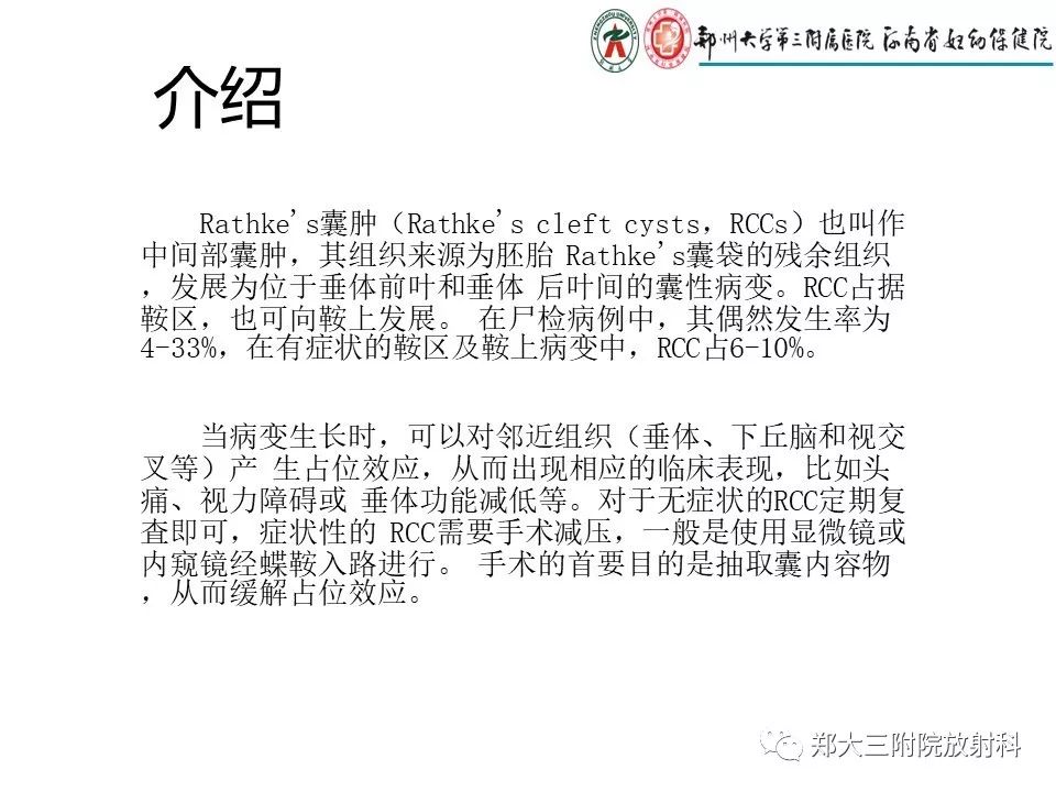 【PPT】Rathke 's 囊肿