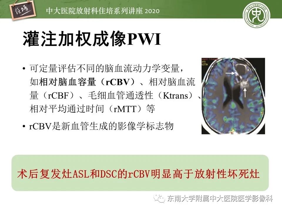 【PPT】胶质瘤复发与放射性脑损伤MR鉴别