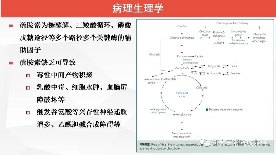 【PPT】Wernicke脑病的影像诊断