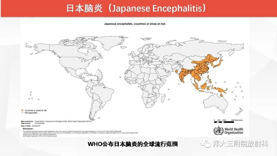 【PPT】Wernicke脑病的影像诊断