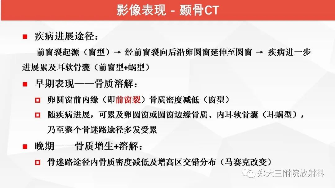 【PPT】耳硬化症的影像诊断