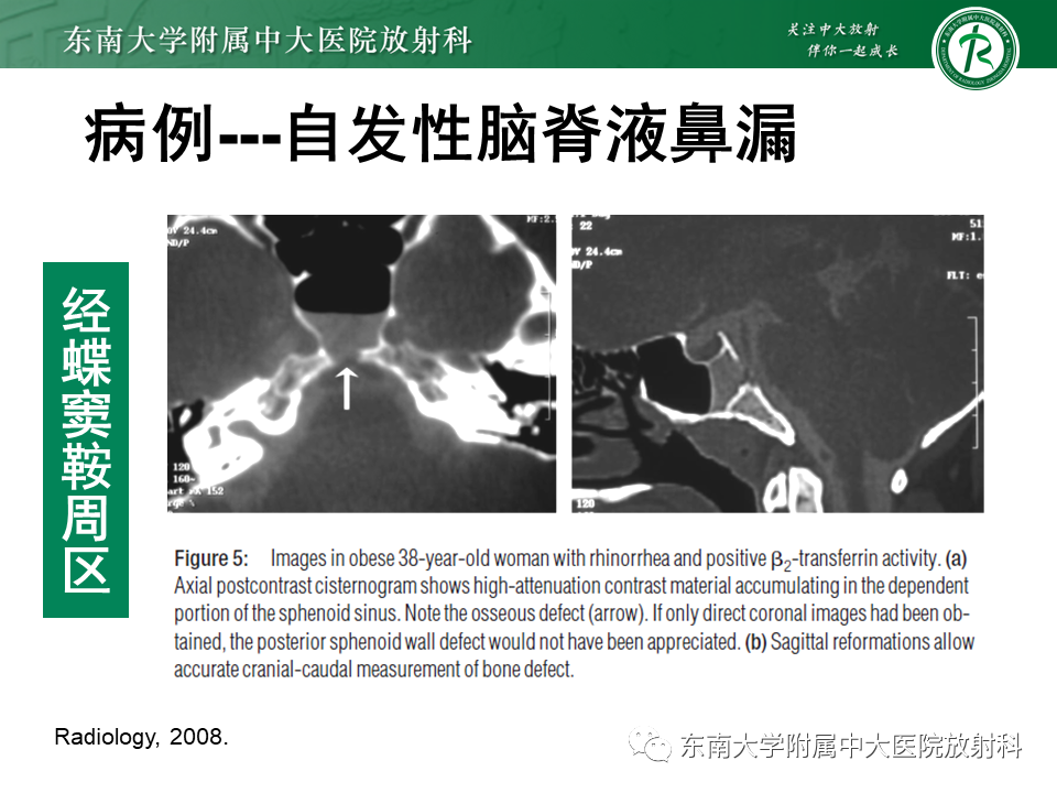 yxppt-2021-01-28_12-16-04_878770