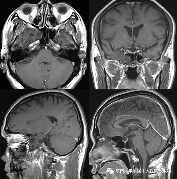 yxppt-2021-01-28_12-15-28_947281