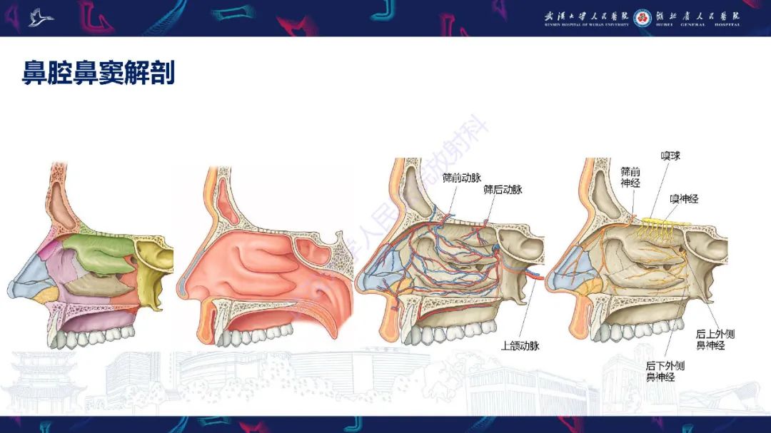 【PPT】鼻腔鼻窦神经内分泌癌影像诊断及鉴别诊断-3