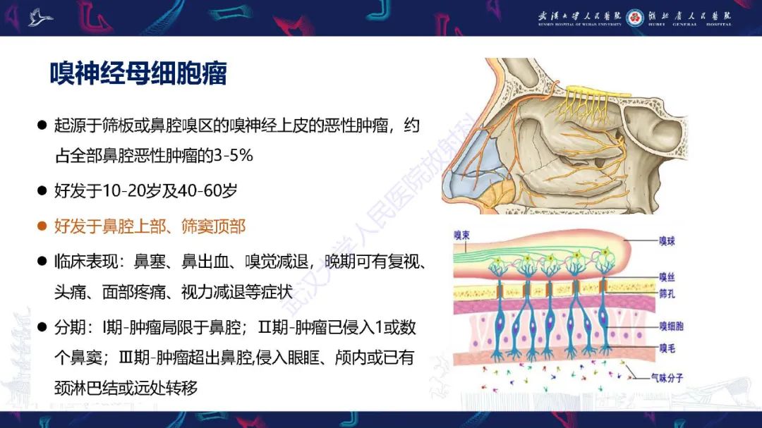 【PPT】鼻腔鼻窦神经内分泌癌影像诊断及鉴别诊断-24