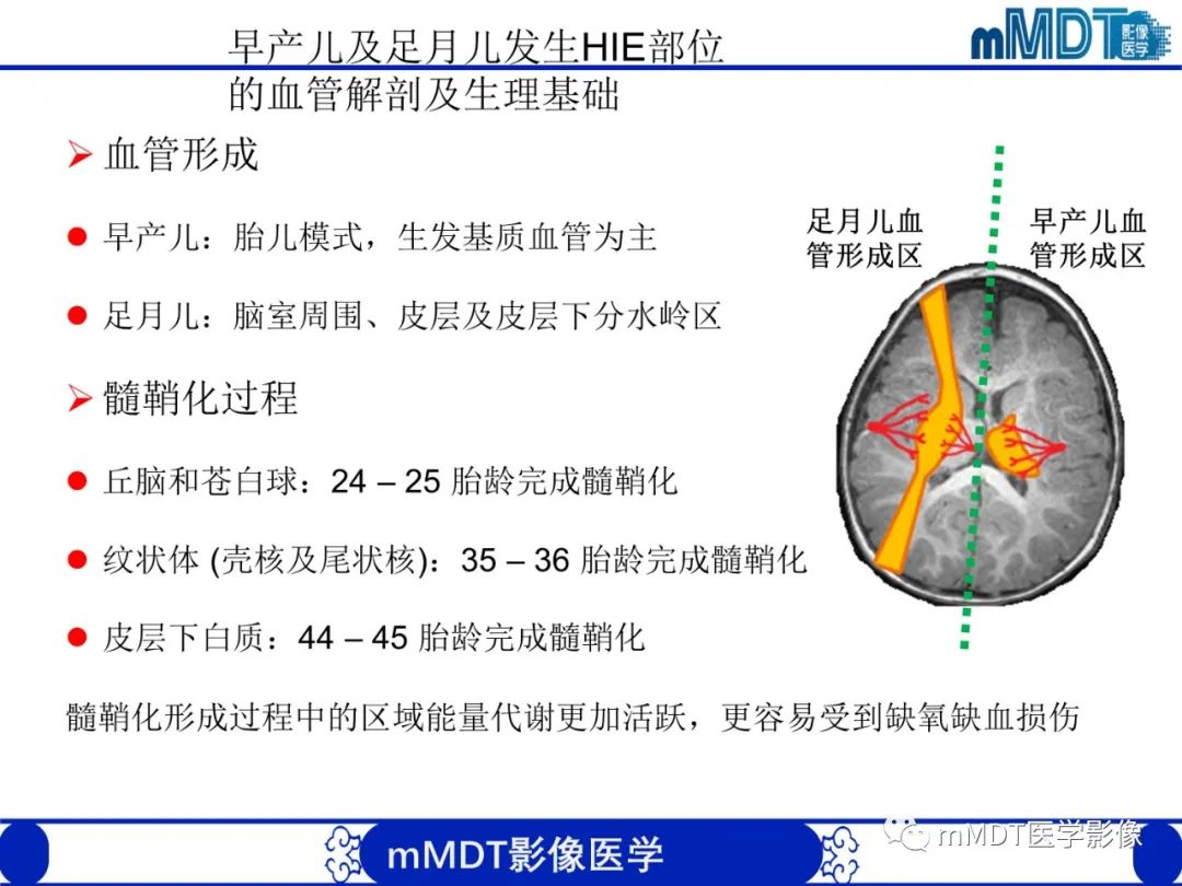 【PPT】新生儿HIE影像学表现-4