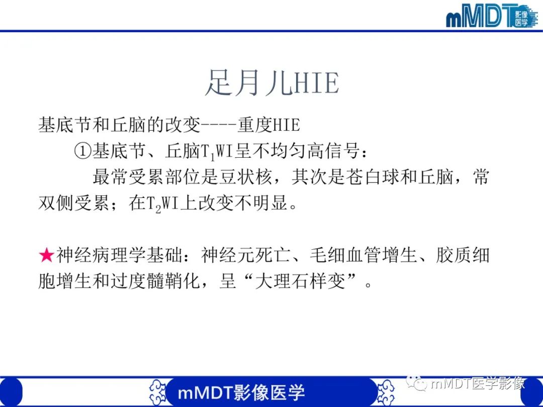 【PPT】新生儿HIE影像学表现-28
