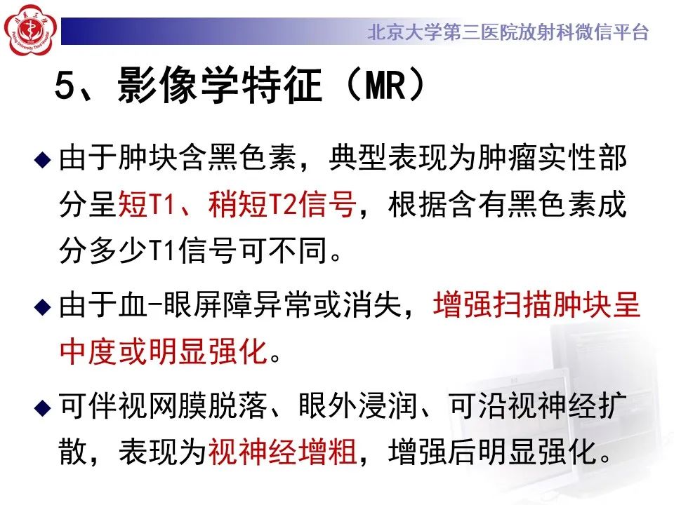 【PPT】脉络膜黑色素瘤的影像-18