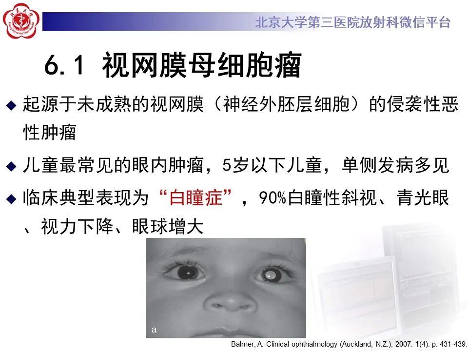 【PPT】脉络膜黑色素瘤的影像-24