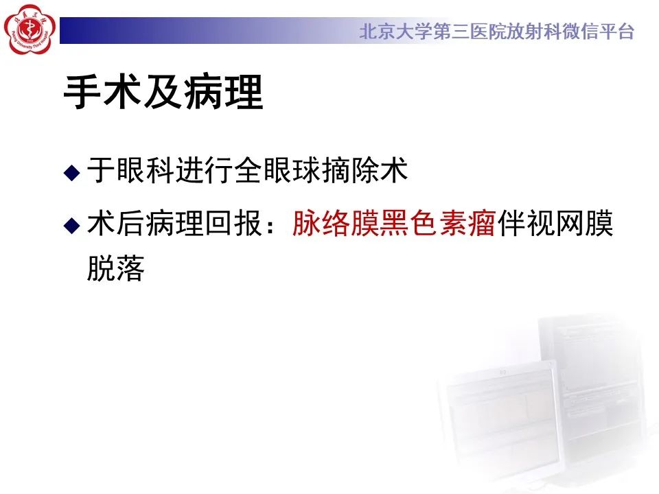 【PPT】脉络膜黑色素瘤的影像-8