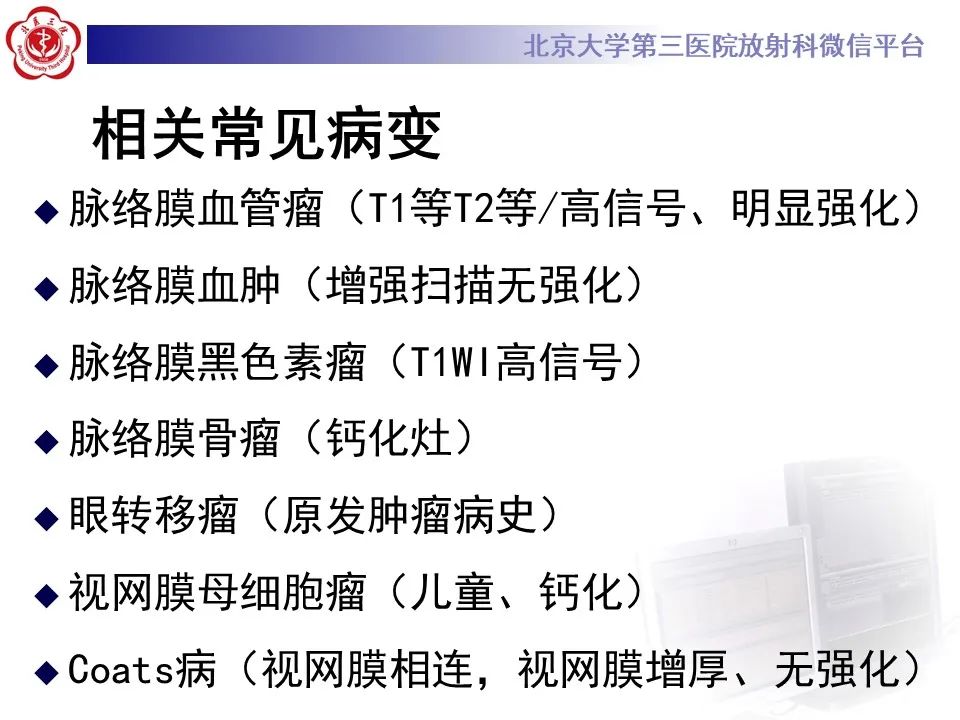 【PPT】脉络膜黑色素瘤的影像-7