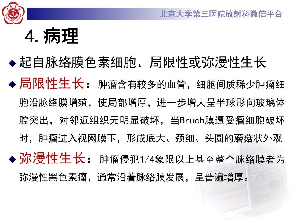 【PPT】脉络膜黑色素瘤的影像-14