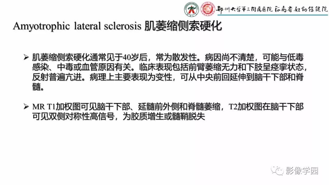 【PPT】脑干病变的影像学表现-32