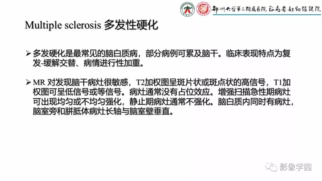 【PPT】脑干病变的影像学表现-28