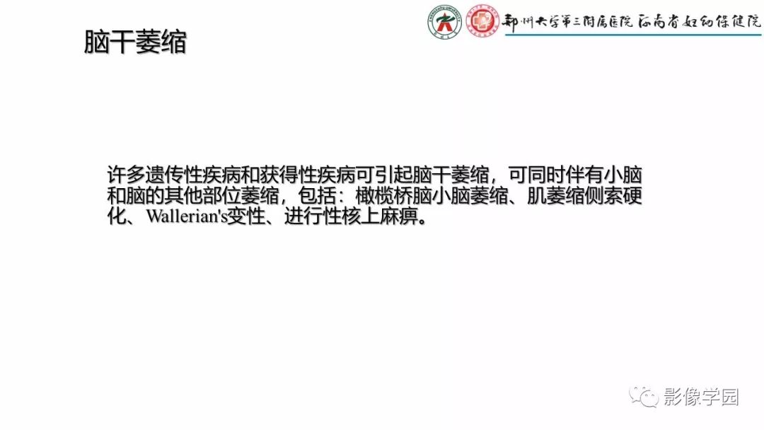 【PPT】脑干病变的影像学表现-29