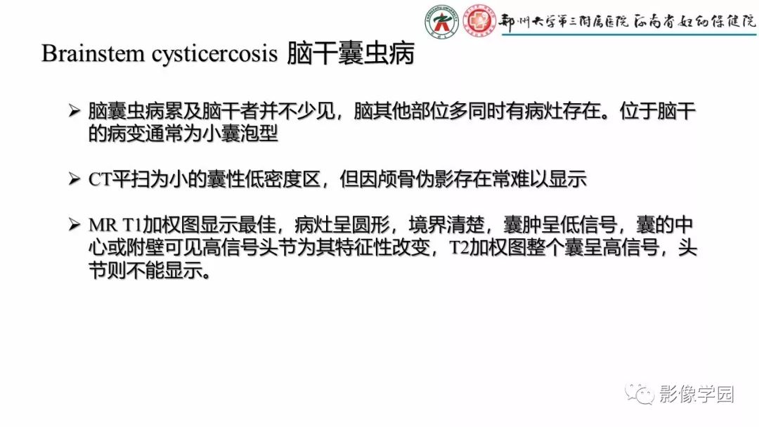 【PPT】脑干病变的影像学表现-21